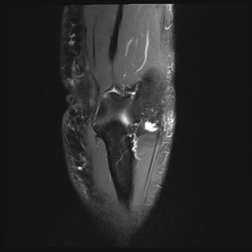 Click on the Serie image to view the images of Wieszt, Gnter